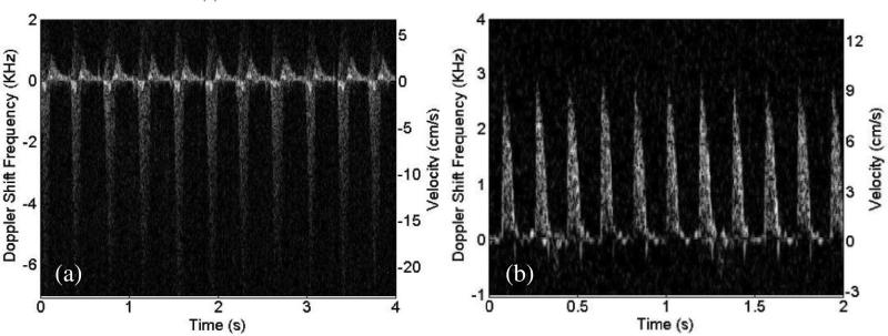 Fig. 25