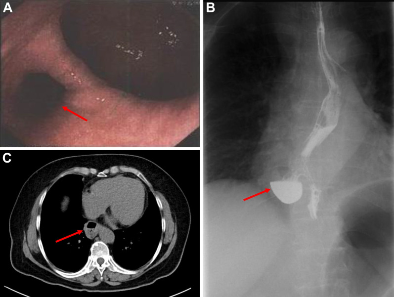 Fig. 1