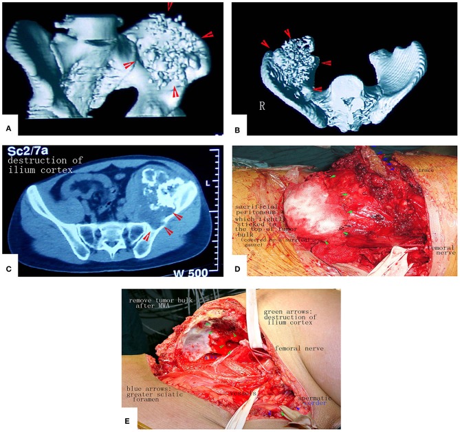 Figure 12