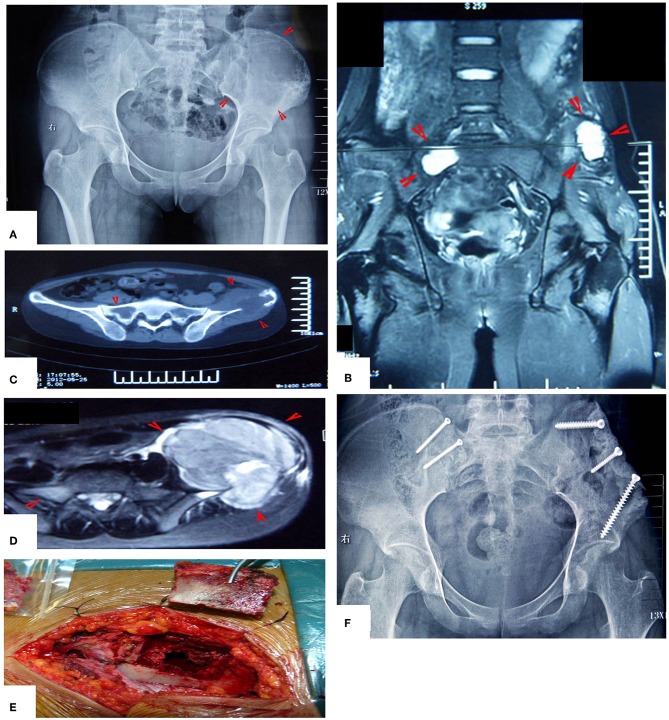 Figure 13