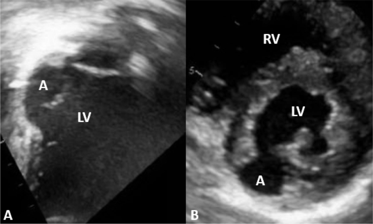 Figure 1