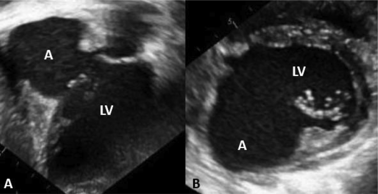 Figure 3