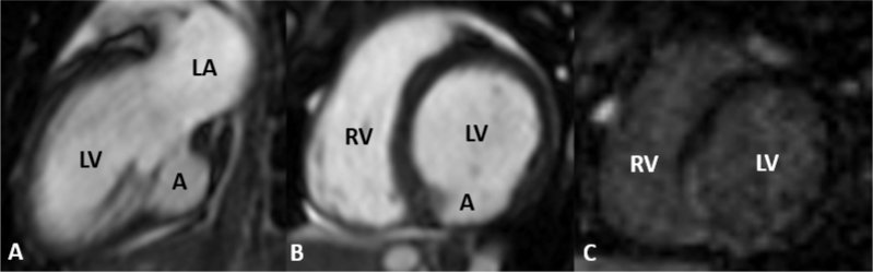 Figure 2