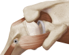 Fig 13