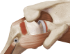 Fig 14