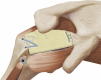 Fig 12