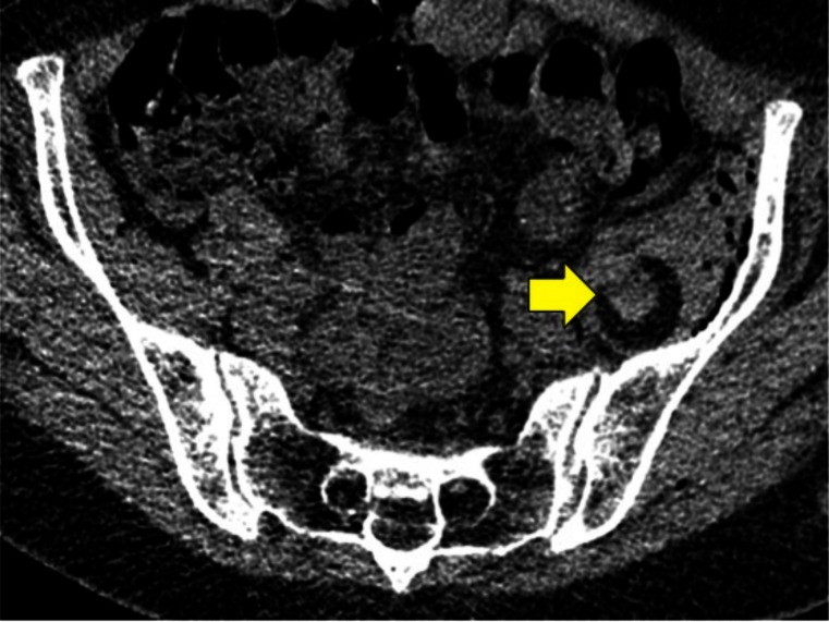 Fig. (2)