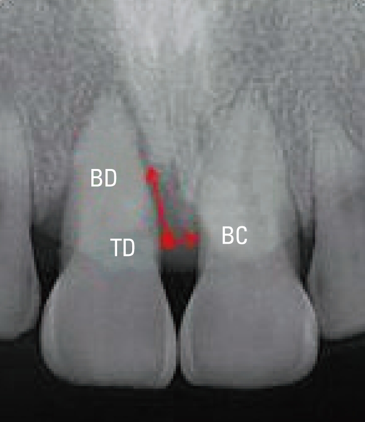 Figure 14