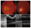 Fig. 4