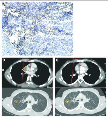 Fig 4.