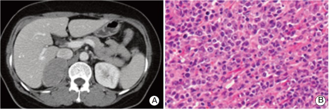 Fig. 2.