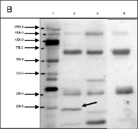 FIGURE 1B: