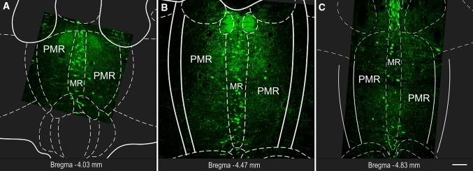 Fig. 1