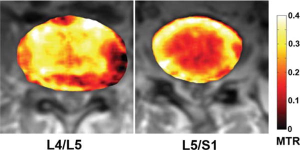 FIG. 10