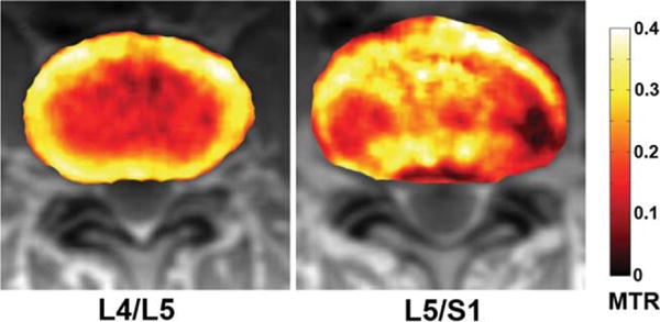 FIG. 9