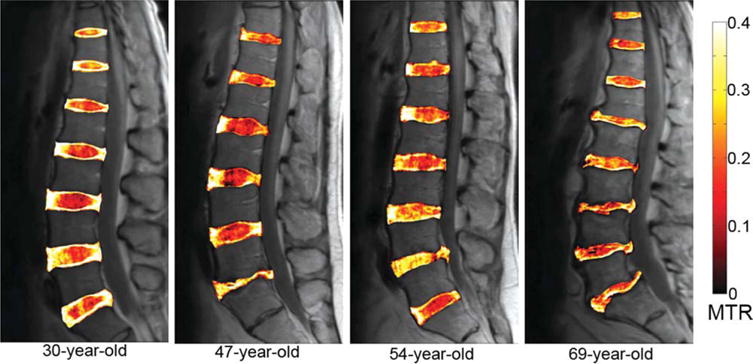 FIG. 6