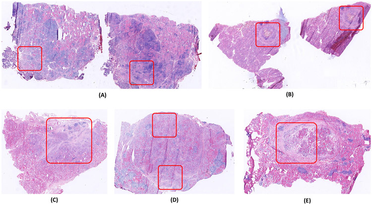 Fig. 11.