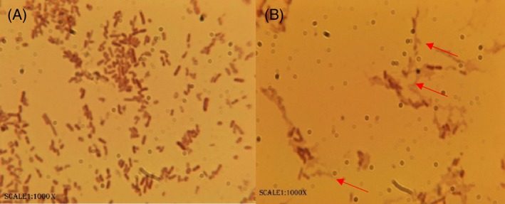 JCTB-5299-FIG-0005-c