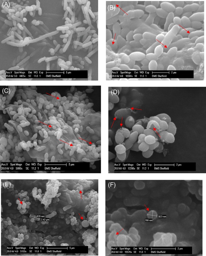 JCTB-5299-FIG-0006-c