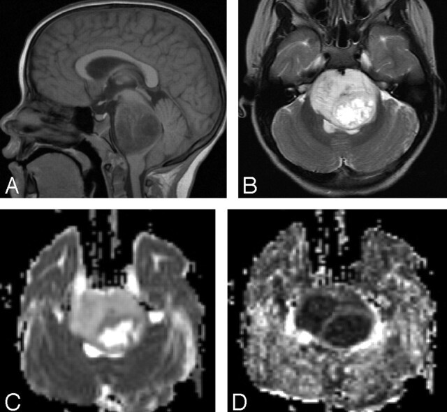 Fig 1.