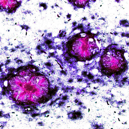 Amyloid plaques, shown here as false-color images, are highly stable structures in vivo