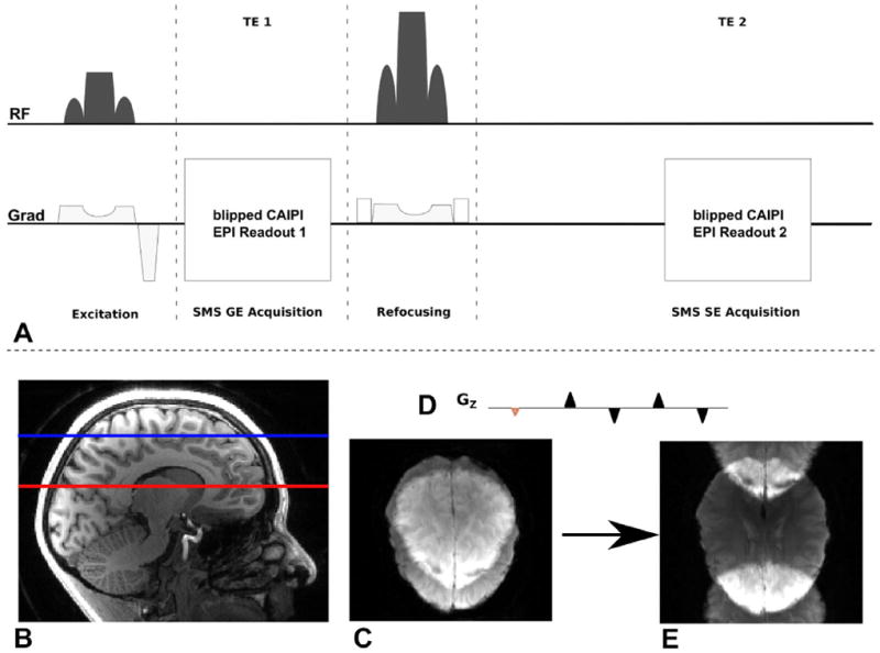 FIG. 1