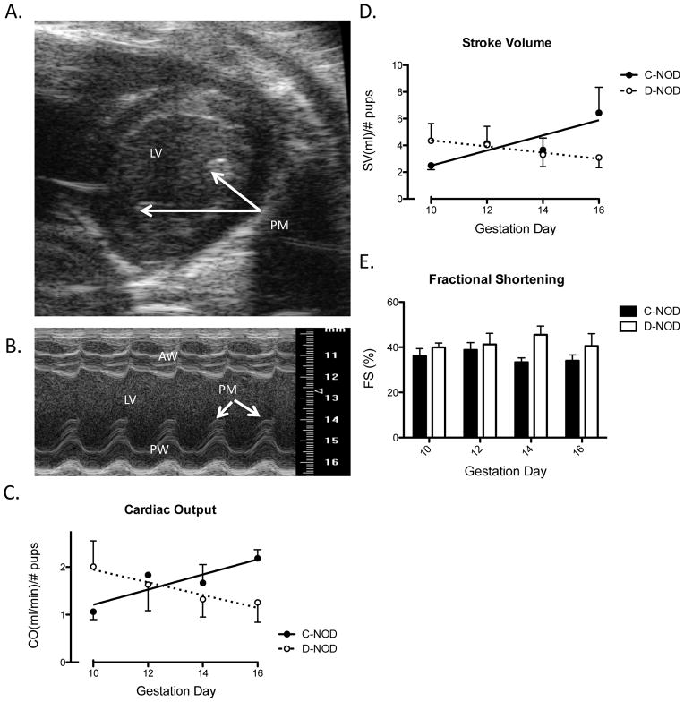 FIG. 1