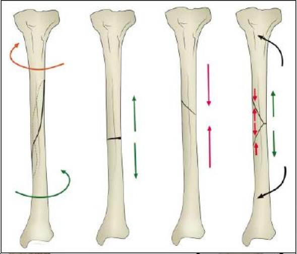 Fig. 10