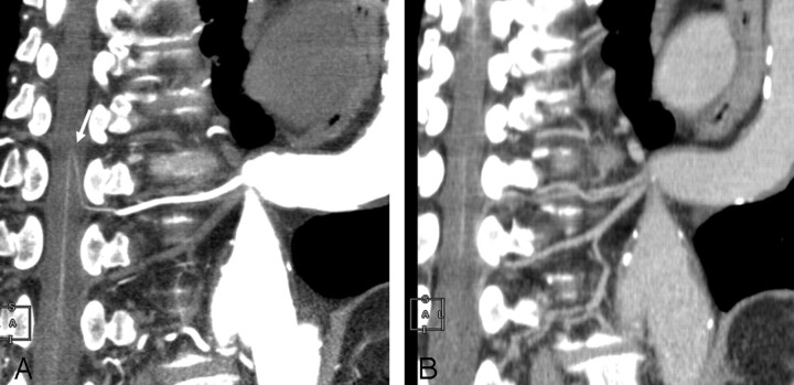 Fig 2.