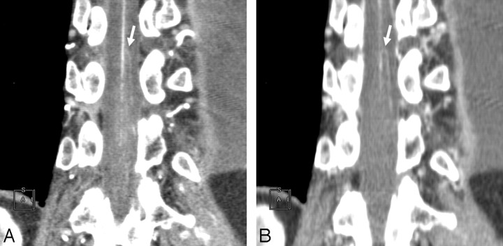 Fig 3.