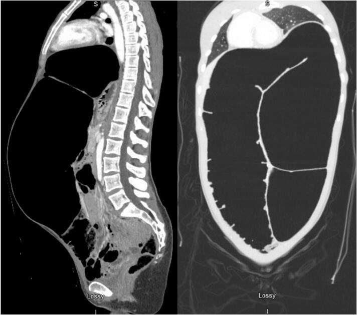 Fig. 2