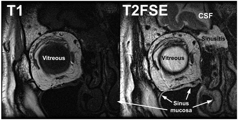 FIG 3