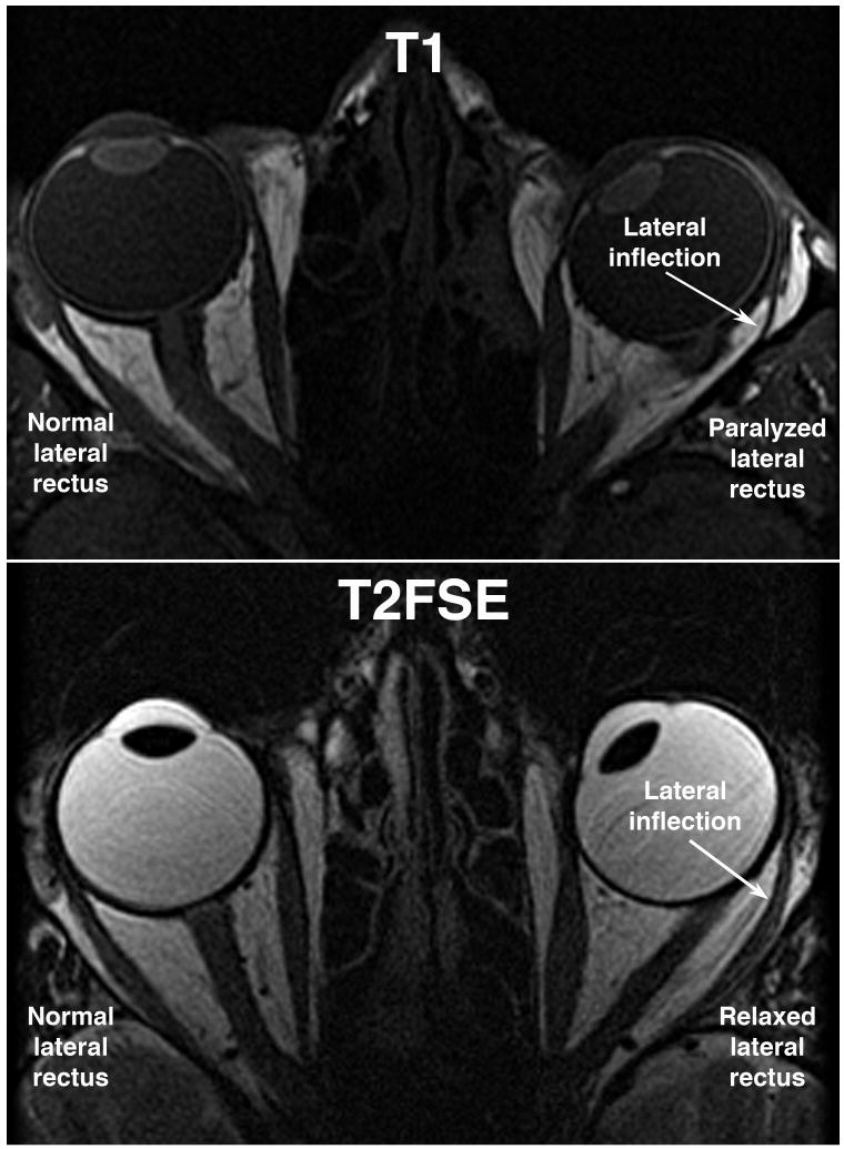 FIG 1