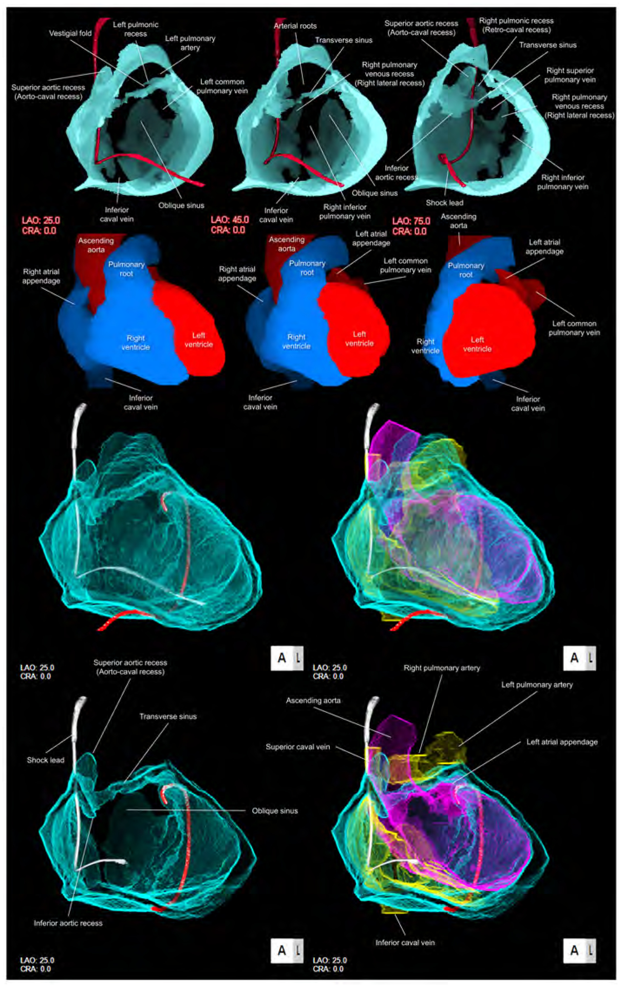 LIVING ANATOMY OF THE PERICARDIAL SPACE: A GUIDE FOR IMAGING AND ...