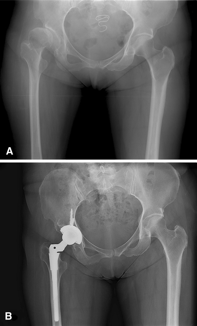 Fig. 1A–B