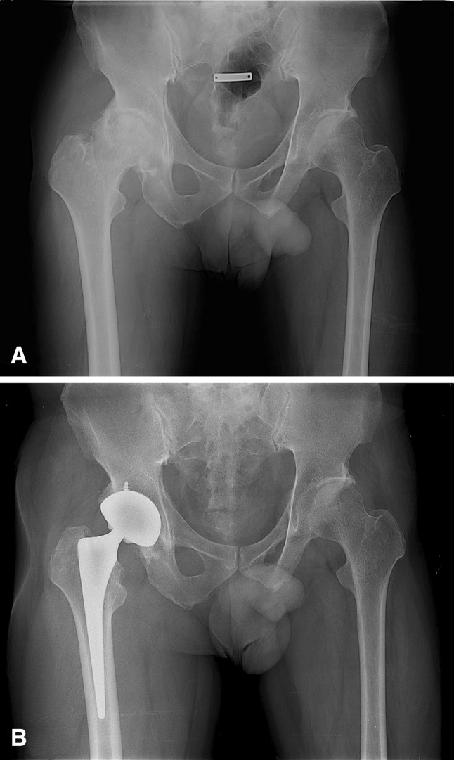 Fig. 2A–B