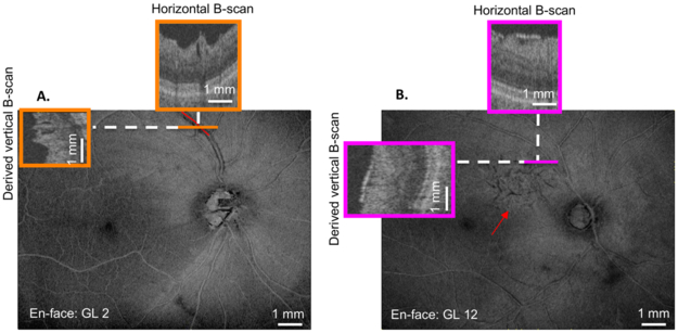 Figure 2: