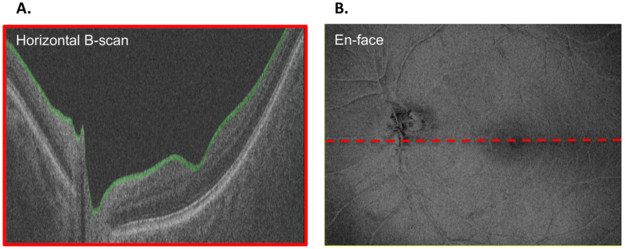 Figure 1: