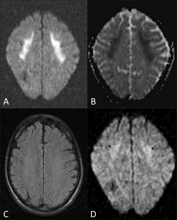 Figure 2 (A-D)