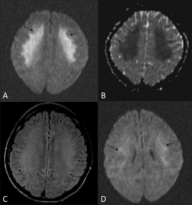 Figure 1 (A-D)