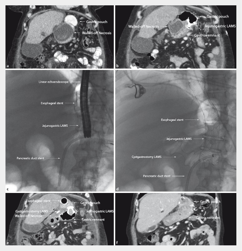 Fig. 2 a