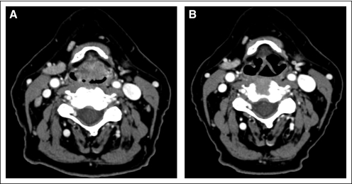 Fig 3.