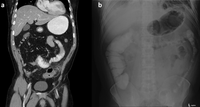 Figure 13.