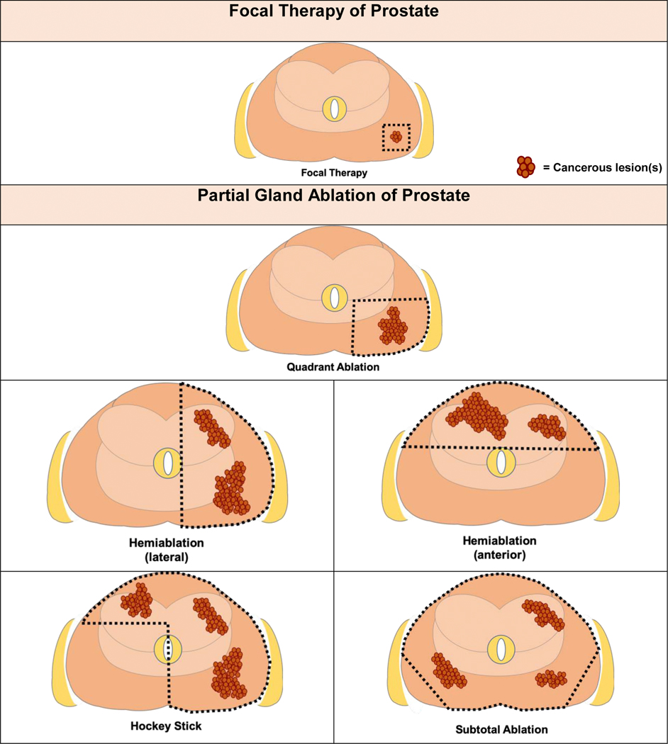 Fig. 1 –