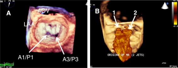 Figure 18