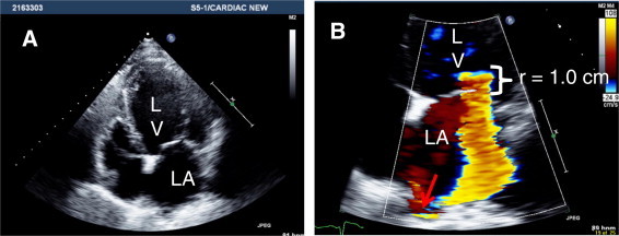 Figure 16