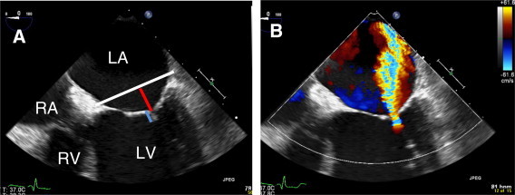 Figure 17