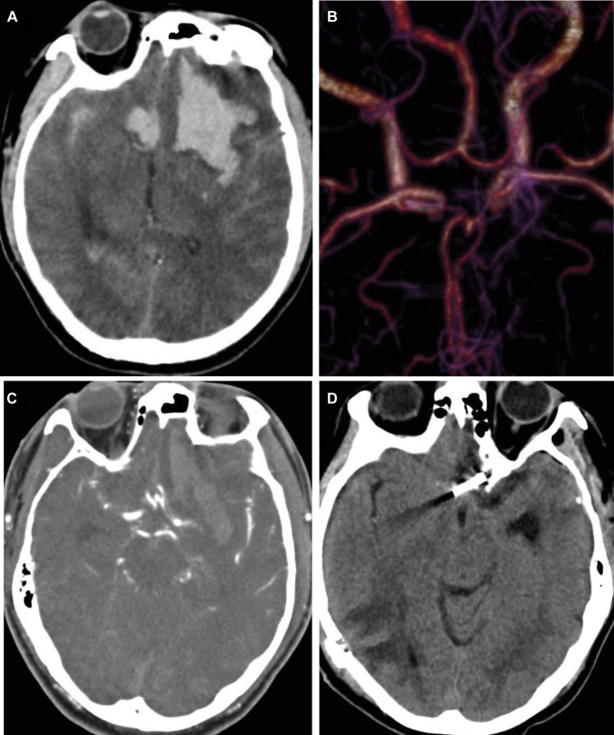 Figure 2