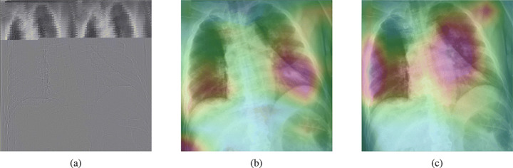 Fig. 18