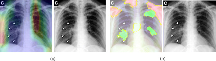 Fig. 14